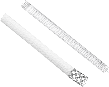 Covered Stent